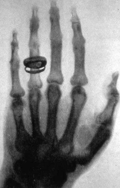 primeira foto da história da radiologia